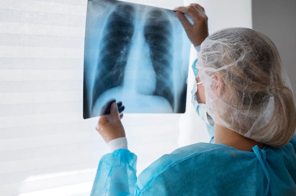 Precio De Consulta De Toracocentesis Diagnostica En Cdmx
